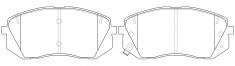 ผ้าเบรค NIBK DB2174 PN0578 BENDIX AUS (017533)